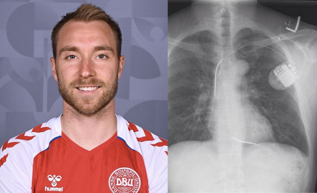Christian Eriksen