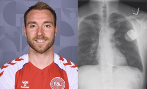 Christian Eriksen